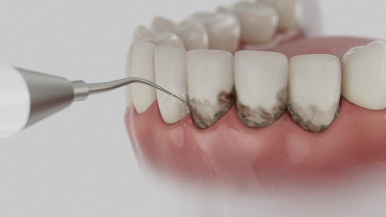 Trusted Teeth Cleaning And Checkup service in Cleona, PA - Dentist Open Now
